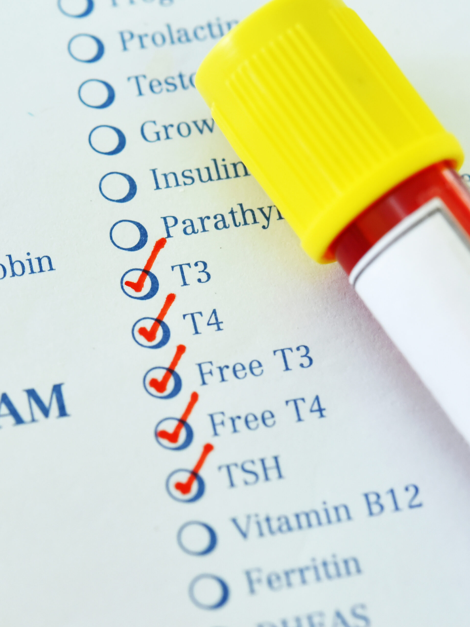 Blood test tubes and a lab requisition form for comprehensive metabolic and hormone testing